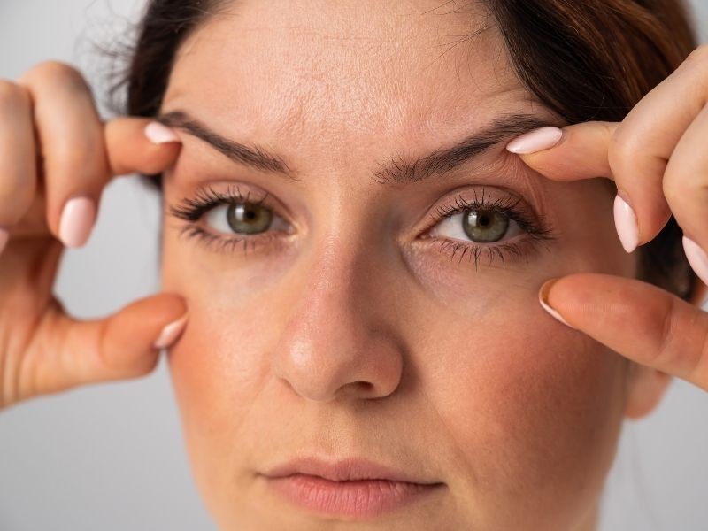Blefaroplastia